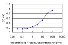 IHC-plus™ PLEK / Pleckstrin Antibody (clone 6E3)