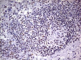 Monoclonal Mouse anti-Human DDX56 Antibody (clone OTI6E8, aa323-547, IHC, WB)