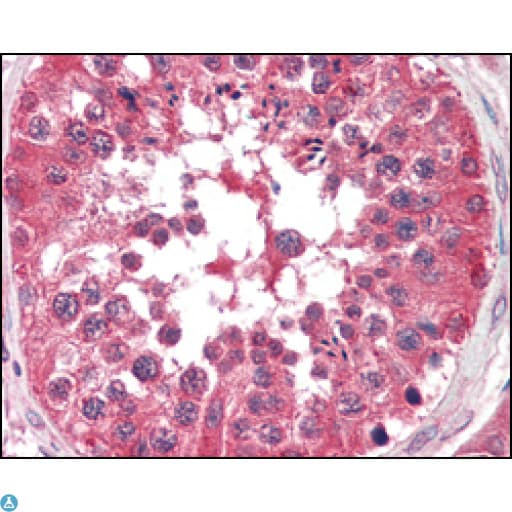 BRAF / B-Raf Antibody