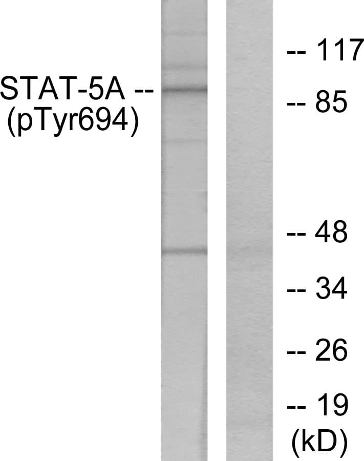 Polyclonal Rabbit anti-Human STAT5 A+B Antibody (phospho-Tyr694, IHC, WB)