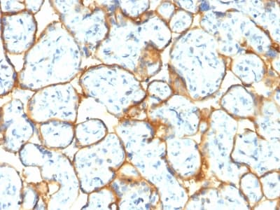 INSR / Insulin Receptor Antibody (clone INSR/2277R)