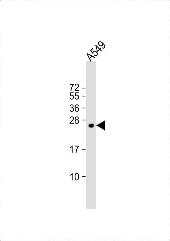 BBC3 / PUMA Antibody (aa158-192)