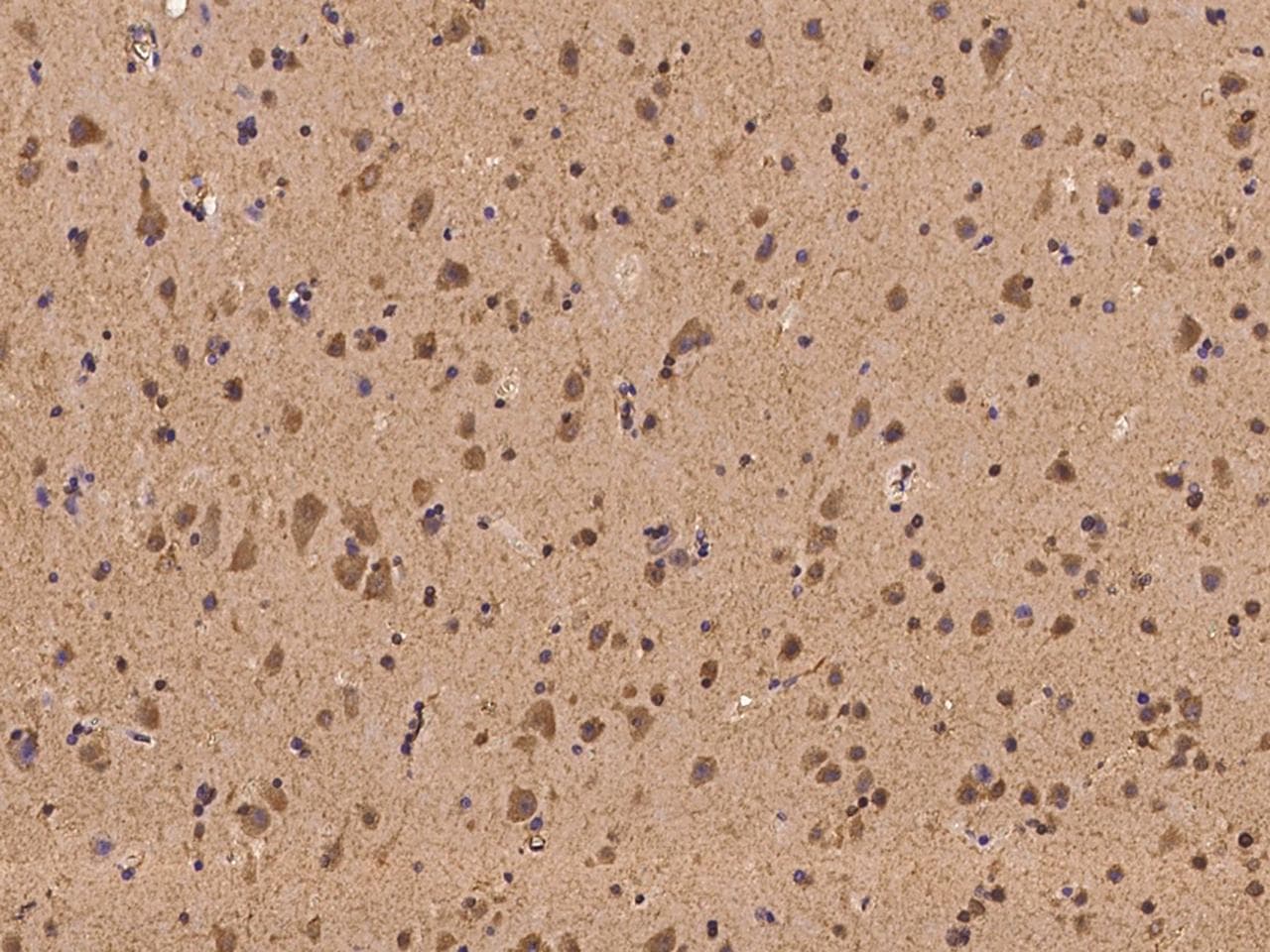 TRPC5 Antibody