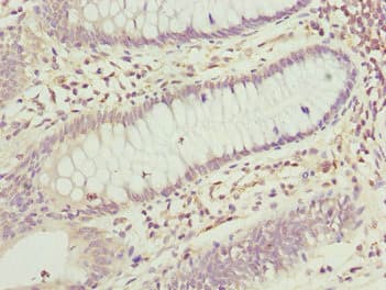 TNRC5 / CNPY3 Antibody