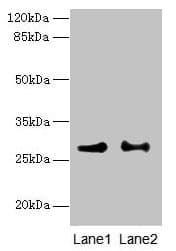 HACD2 / PTPLB Antibody