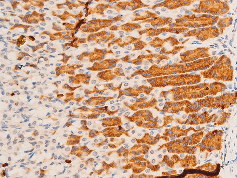Polyclonal Rabbit anti-Human JUN / c-Jun Antibody (phospho-Tyr170, IHC, WB)