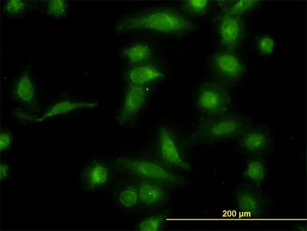 IHC-plus™ Monoclonal Mouse anti-Human AKR1B10 Antibody (clone 1A6, IHC, IF, WB)