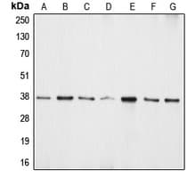 APEX1 / APE1 Antibody (Internal)