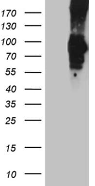 PCSK9 Antibody (aa153-692, clone OTI8C12, Carrier-free)