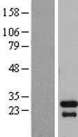 TGIF2LX Protein (Over-Expression Lysate Myc-DDK (Flag))