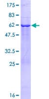Human TBC1D7 Protein (Recombinant GST)