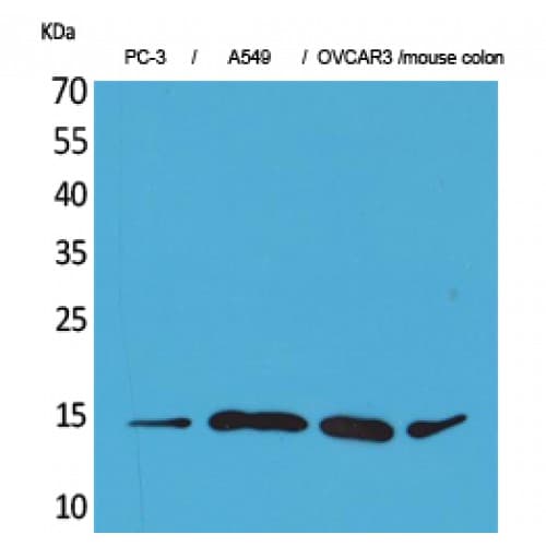 Polyclonal Rabbit anti-Human CCL26 / Eotaxin 3 Antibody (Internal, WB)