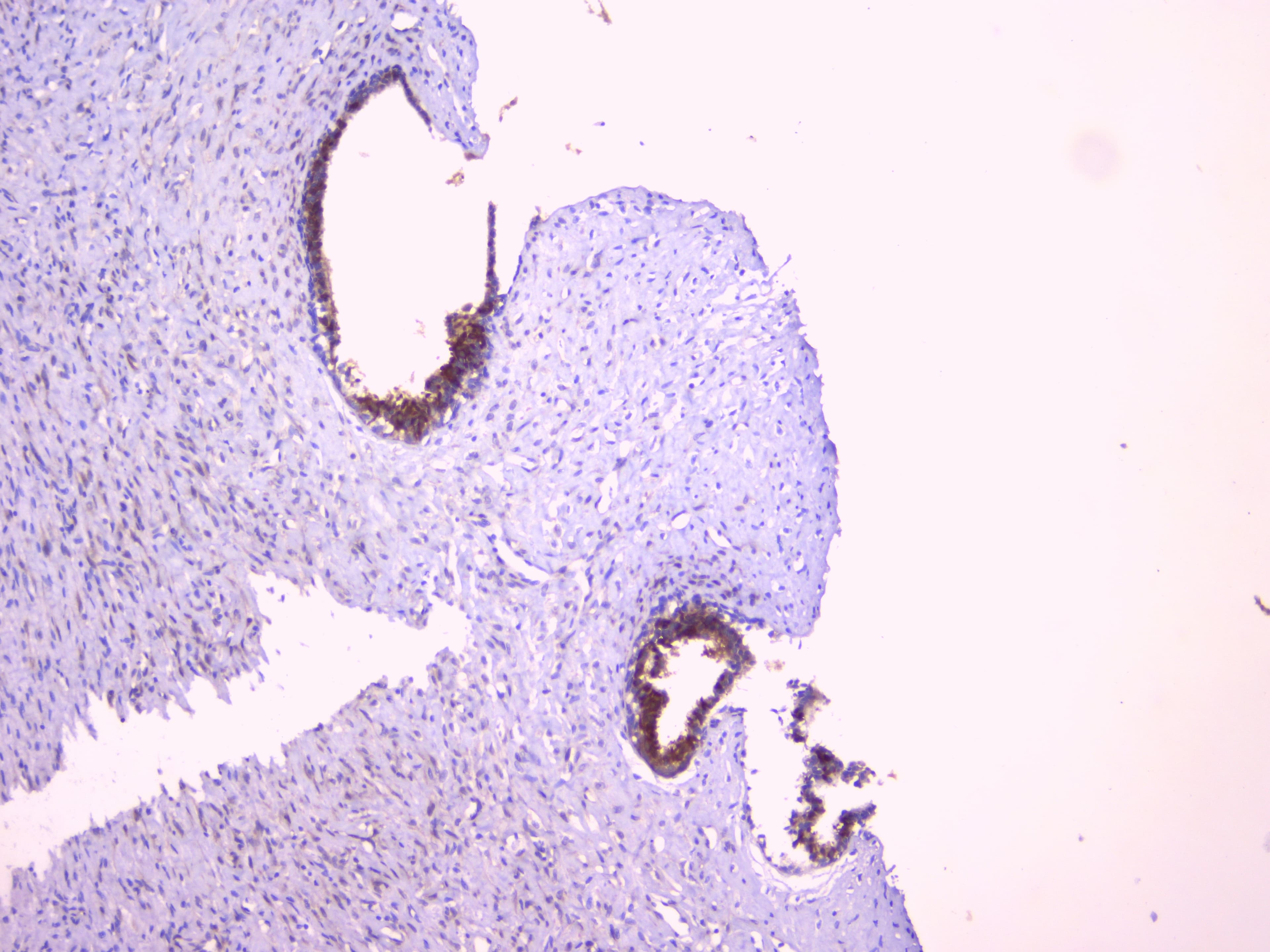 Polyclonal Rabbit anti-Human PEBP1 / RKIP Antibody (WB)