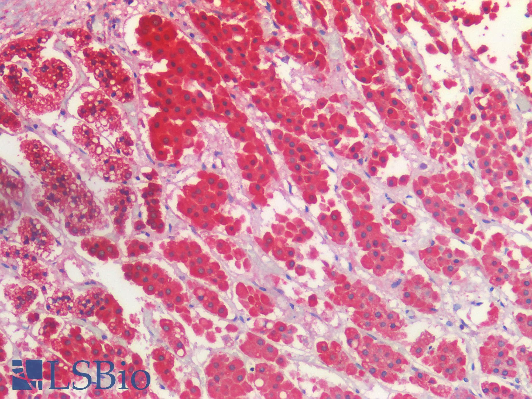 IHC-plus™ HADHA Antibody