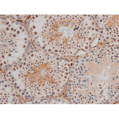 AP-1 / JUND Antibody (phospho-Ser255)