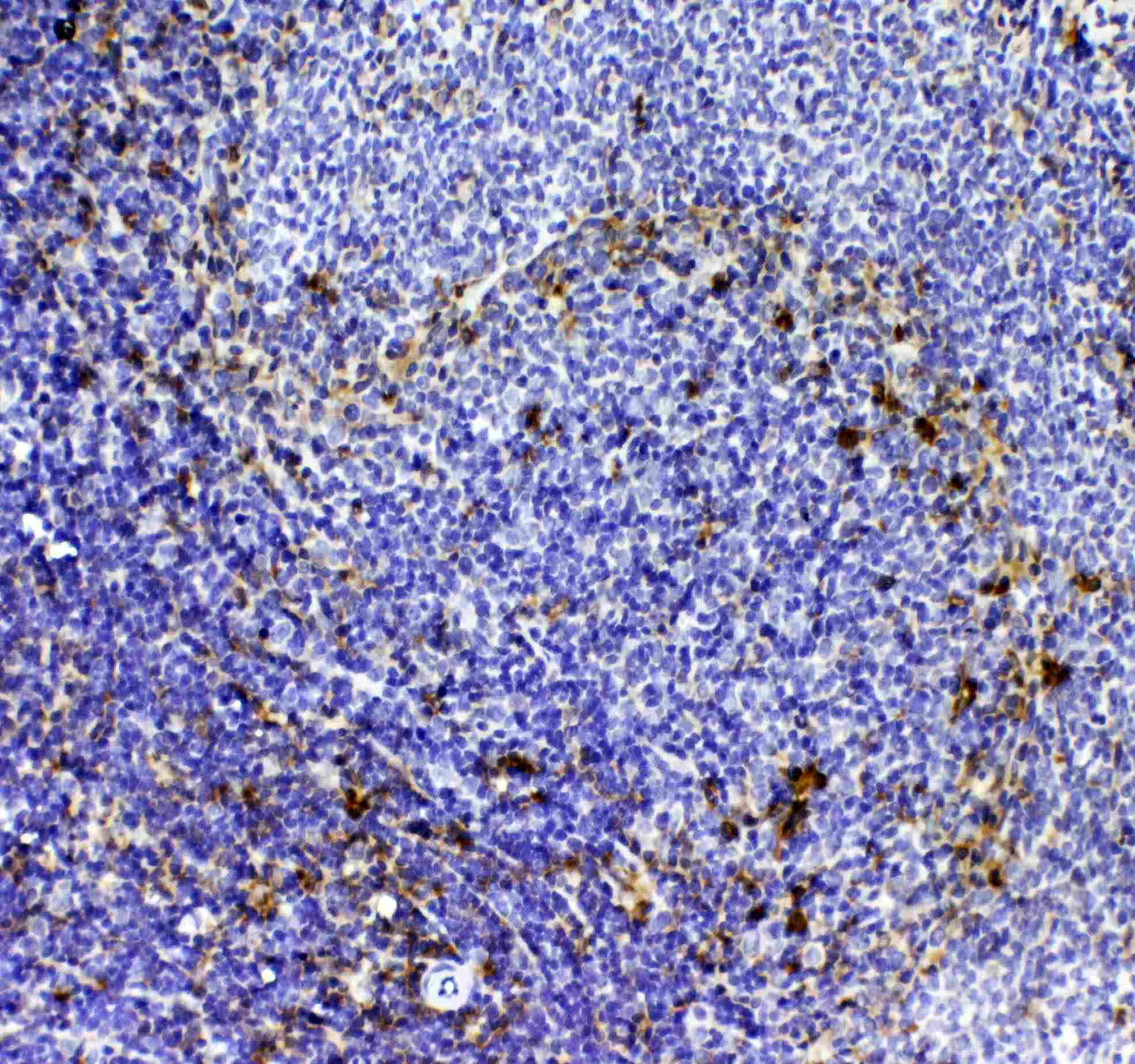 CD8A / CD8 Alpha Antibody