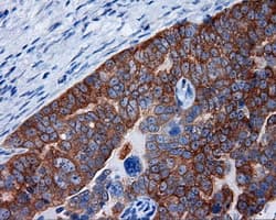 Monoclonal Mouse anti-Human RIP1 / RALBP1 Antibody (clone OTI2A6, IHC, IF, WB)