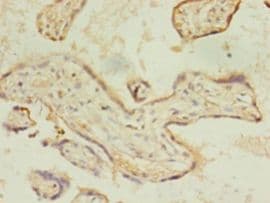 ACSL4 / FACL4 Antibody