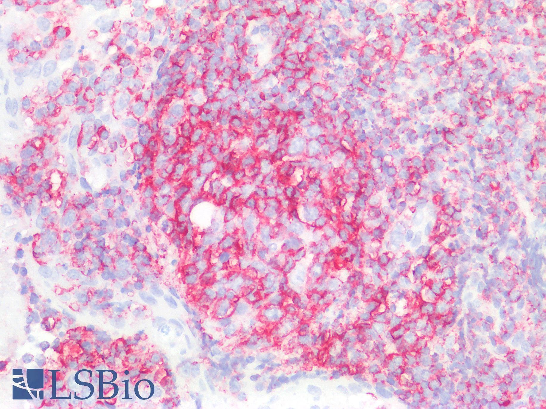 IHC-plus™ Polyclonal Rabbit anti-Human CD45 / LCA Antibody (IHC, WB)