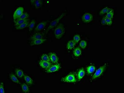 Polyclonal Rabbit anti-Human HMG-CoA Reductase / HMGCR Antibody (IHC, WB)