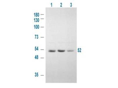 Polyclonal Rabbit anti-Human GSK3A / GSK3 Alpha Antibody (phospho-Ser21, IF, WB)