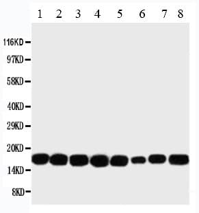 NME1 / NM23 Antibody (aa137-152)