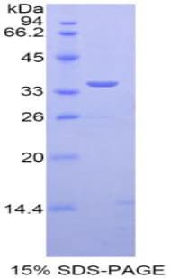 Mouse TFPI / LACI Protein (Recombinant His-T7)