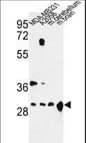 YWHAZ / 14-3-3 Zeta Antibody (aa65-93)