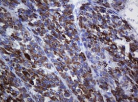 AMACR / P504S Antibody (clone OTI2A11, Carrier-free)