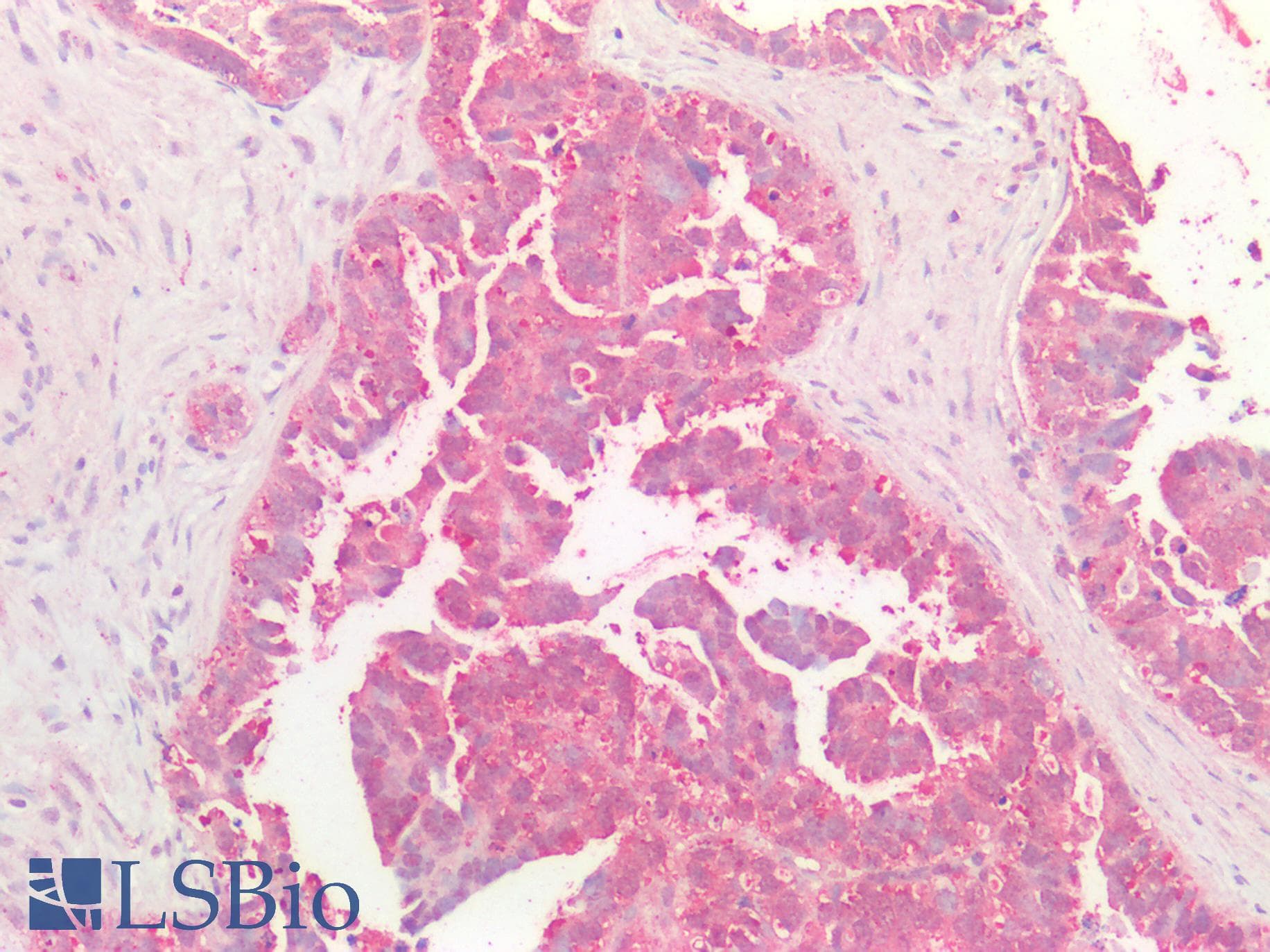 IHC-plus™ MYC / c-Myc Antibody
