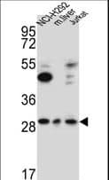 TAF1D Antibody (aa62-90)