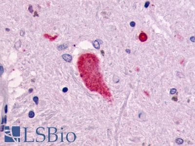 PathPlus™ Polyclonal Rabbit anti-Human RXFP1/ LGR7 Antibody (N-Terminus, IHC)