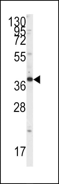 Polyclonal Rabbit anti-Human SH3GLB1 / Bif / Endophilin B1 Antibody (Tyr80, IHC, WB)