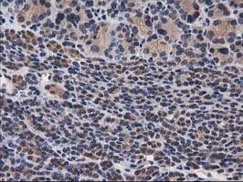 DSTN / Destrin Antibody (clone OTI2C10)