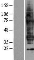 FP / PTGFR Protein (Over-Expression Lysate Myc-DDK (Flag))