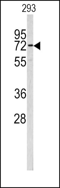 CEA / Carcinoembryonic Antigen Antibody (aa400-429)