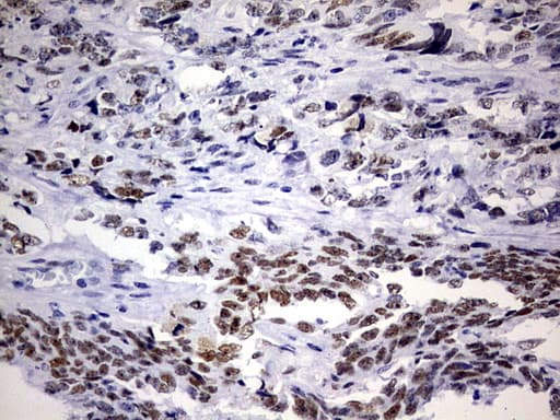 Monoclonal Mouse anti-Human NAB1 Antibody (clone OTI1D2, aa237-487, IHC, WB)