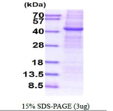Human APMAP / C20orf3 Protein (Recombinant His)