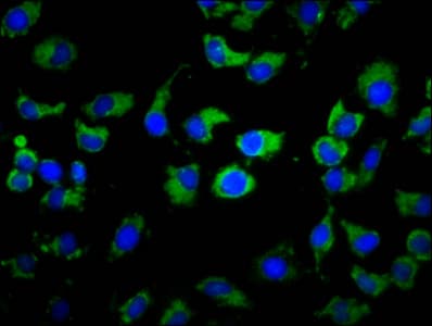 Polyclonal Rabbit anti-Human MS4A2 / FCERI Antibody (IHC, IF)