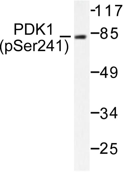Polyclonal Rabbit anti-Human PDPK1 / PDK1 Antibody (phospho-Ser241, IHC, WB)