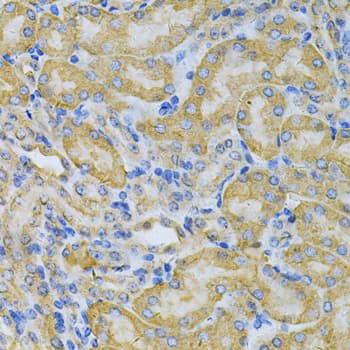 Polyclonal Rabbit anti-Human PGK1 / Phosphoglycerate Kinase Antibody (IHC, WB)