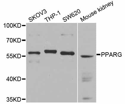 IHC-plus™ Polyclonal Rabbit anti-Human PPARG / PPAR Gamma Antibody (IHC, WB)