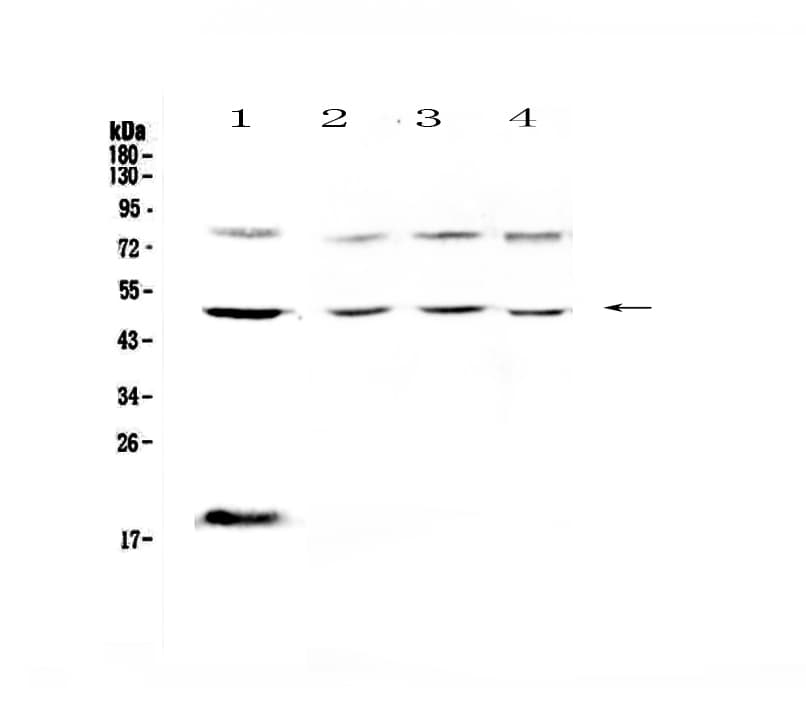 Polyclonal Rabbit anti-Human FCGR1A / CD64 Antibody (WB)
