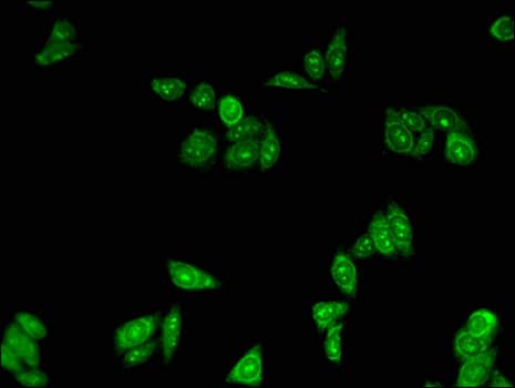 PLIN3 / M6PRBP1 / TIP47 Antibody