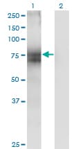 IHC-plus™ STT3A / ITM1 Antibody (clone 4D4)