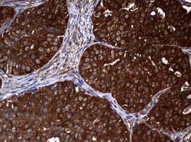 NME1 / NM23 Antibody (clone OTI7A1)
