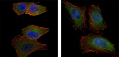 IHC-plus™ AKT2 Antibody (clone 1B6)