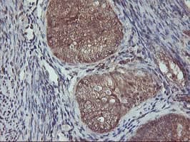 AKT1 Antibody (clone OTI4D6)