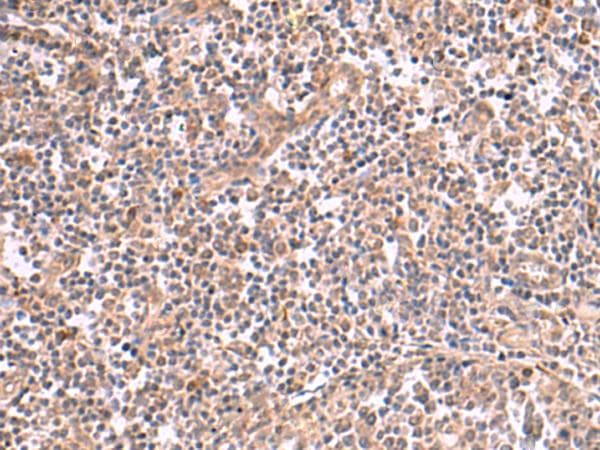 SLC12A7 / KCC4 Antibody