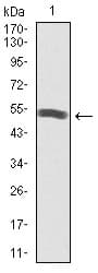 IHC-plus™ PIK3R1 / p85 Alpha Antibody (clone 6G10)